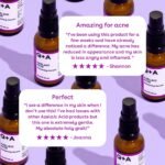 Q+A Azelaic Acid Facial Serum 30ml – Image 5